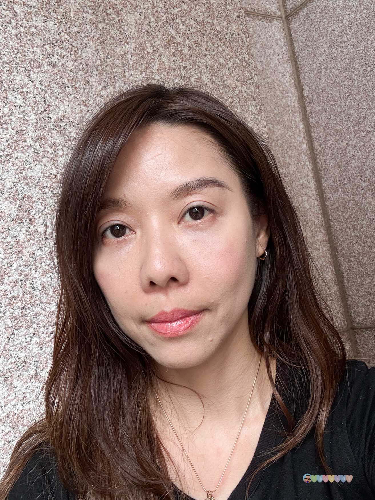 台北|容華診所》台北東區Ellansé洢蓮絲推薦,改善法令紋及凹陷困擾,偷偷自然變美的秘密。 - 第40張圖