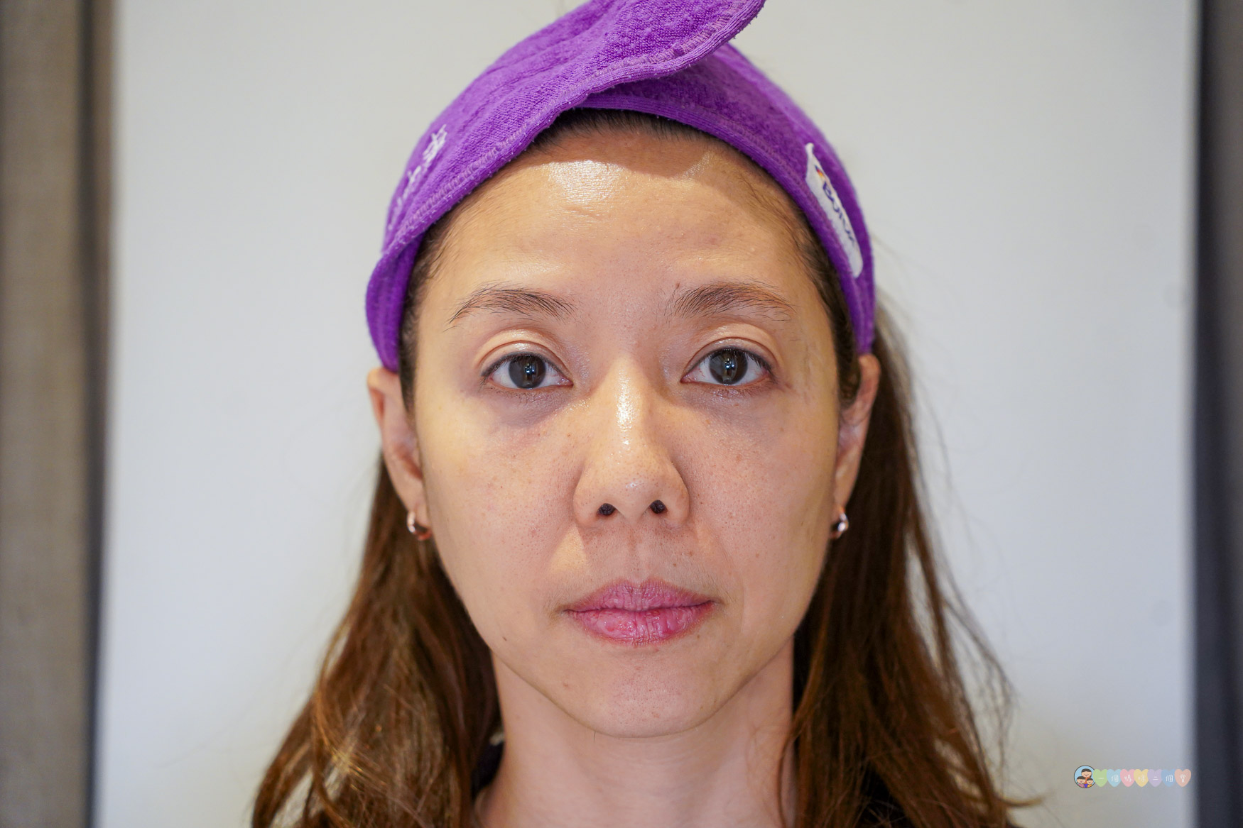 台北|容華診所》台北東區Ellansé洢蓮絲推薦,改善法令紋及凹陷困擾,偷偷自然變美的秘密。 - 第32張圖