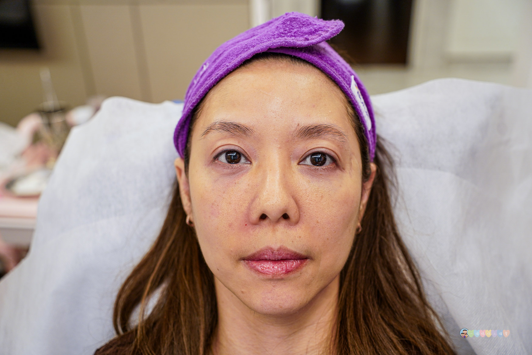 台北|容華診所》台北東區Ellansé洢蓮絲推薦,改善法令紋及凹陷困擾,偷偷自然變美的秘密。 - 第38張圖