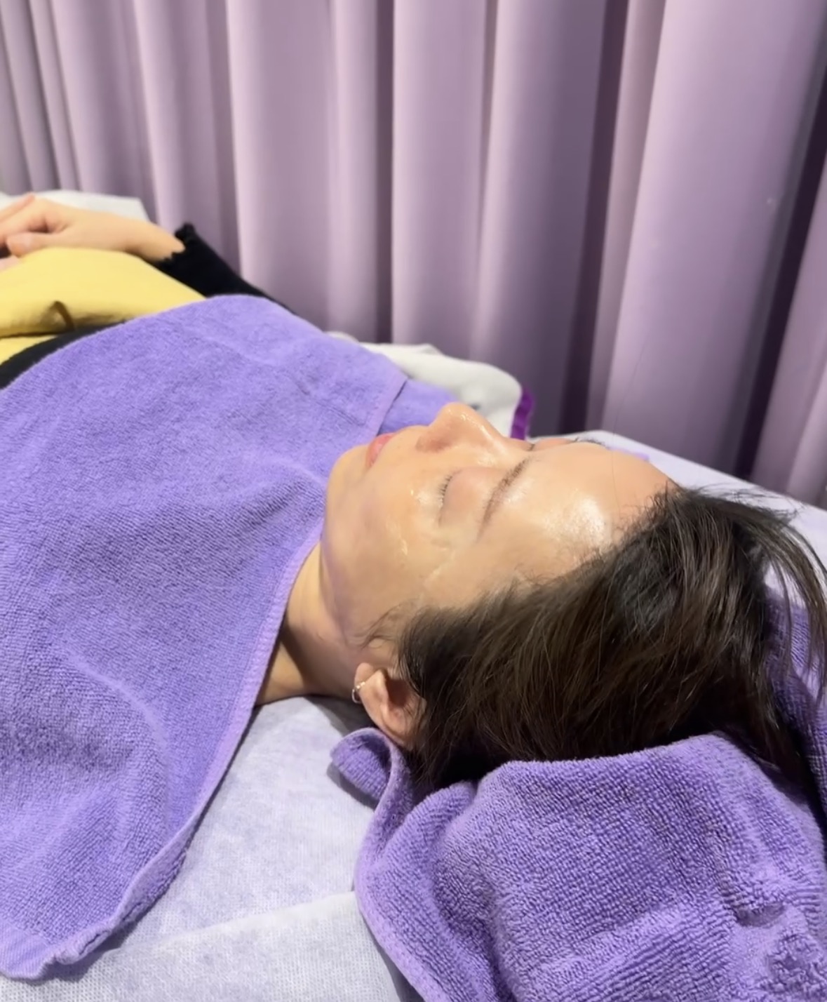 新北|愛爾麗診所(板橋店)》 Dual HI雙子極線音波 韓國黑科技,6倍能量拉提 雙線擊發高效率。 - 第10張圖 新北|愛爾麗診所(板橋店)》 Dual HI雙子極線音波 韓國黑科技,6倍能量拉提 雙線擊發高效率。