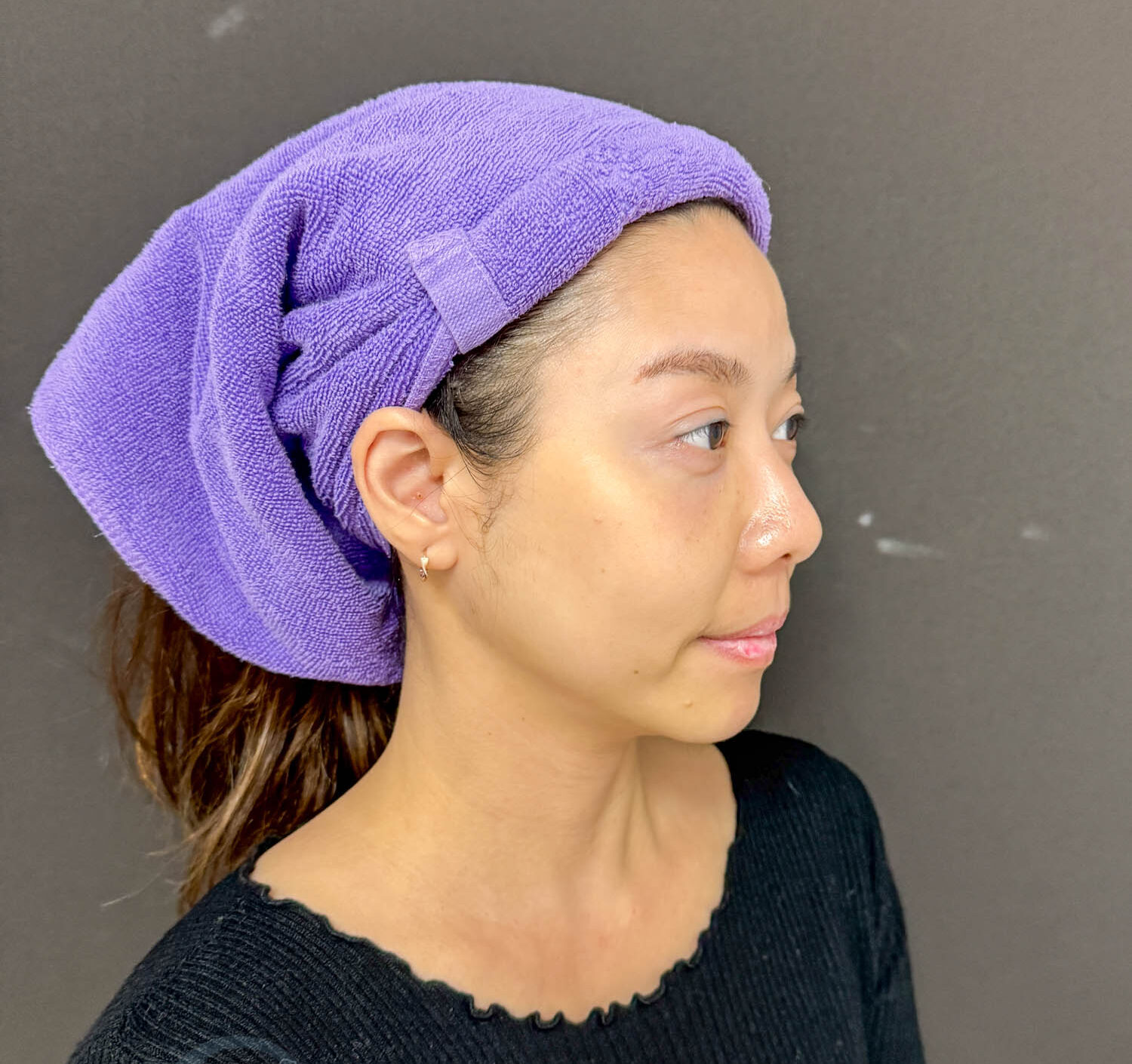 新北|愛爾麗診所(板橋店)》 Dual HI雙子極線音波 韓國黑科技,6倍能量拉提 雙線擊發高效率。 - 第7張圖 新北|愛爾麗診所(板橋店)》 Dual HI雙子極線音波 韓國黑科技,6倍能量拉提 雙線擊發高效率。